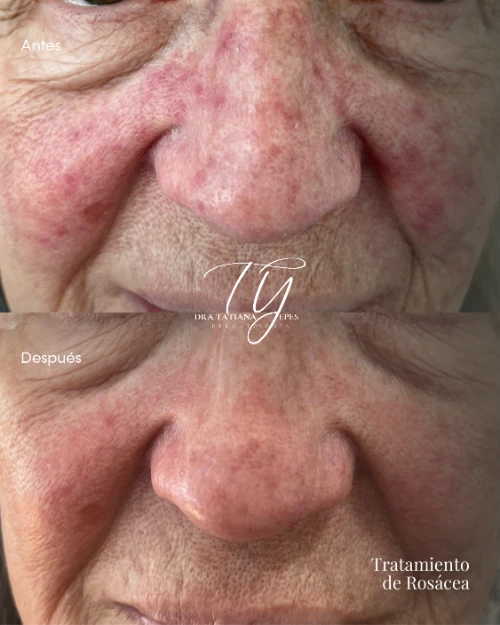 Antes y después-03(1)