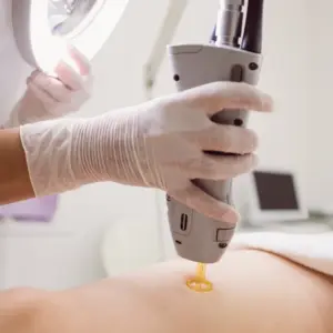 Láser para Cicatrices Postquirúrgicas