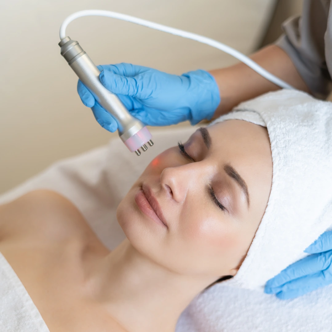 Láser para Rejuvenecimiento Facial