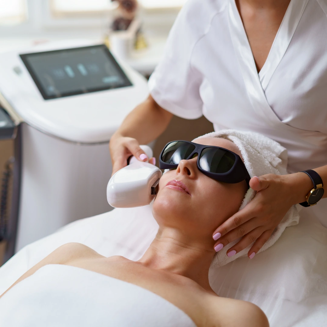 Láser CO2 (Rejuvenecimiento profundo)